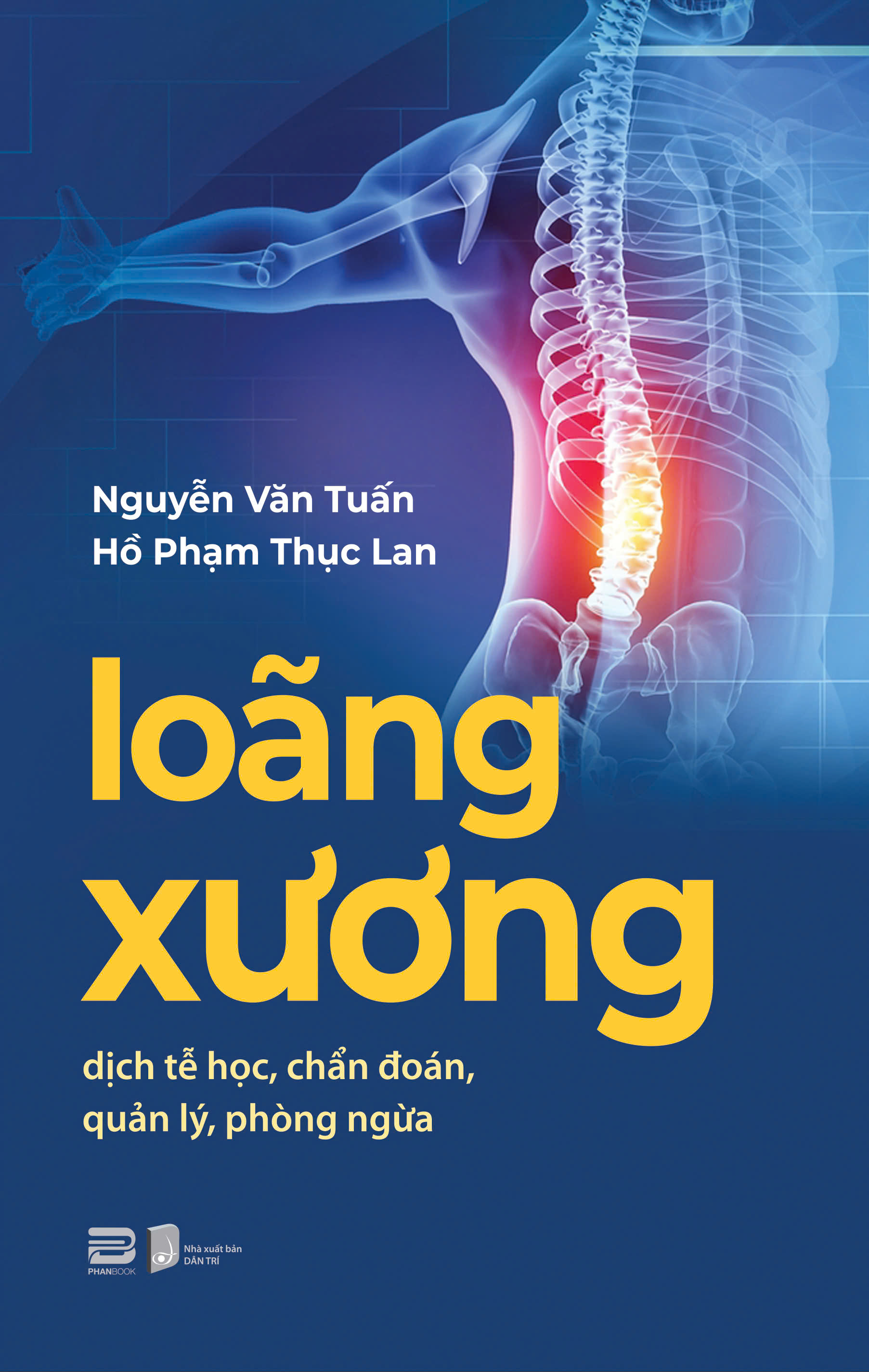 Loãng Xương - Dịch Tễ Học, Chẩn Đoán, Quản Lý, Phòng Ngừa - Ảnh 2